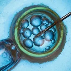 辅助生殖技术（ART）完全指南：IVF、ICSI、IUI等全解析与全球决策手册