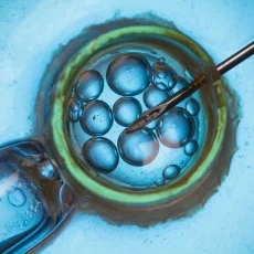 辅助生殖技术（ART）完全指南：IVF、ICSI、IUI等全解析与全球决策手册