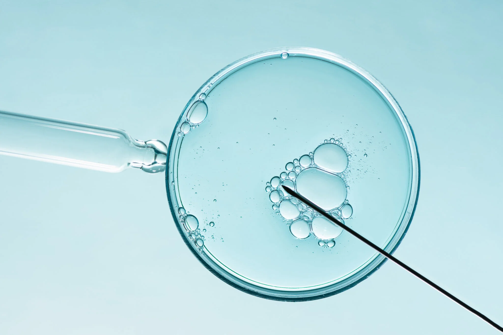IVF とは（试管婴儿）是什么？完整科普指南