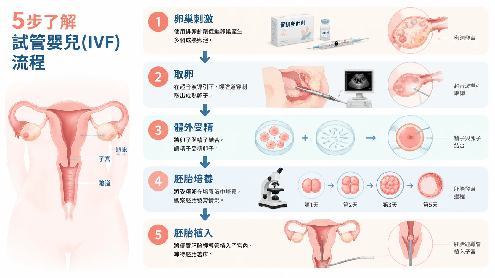 试管婴儿、IVF、体外受精有什么区别？