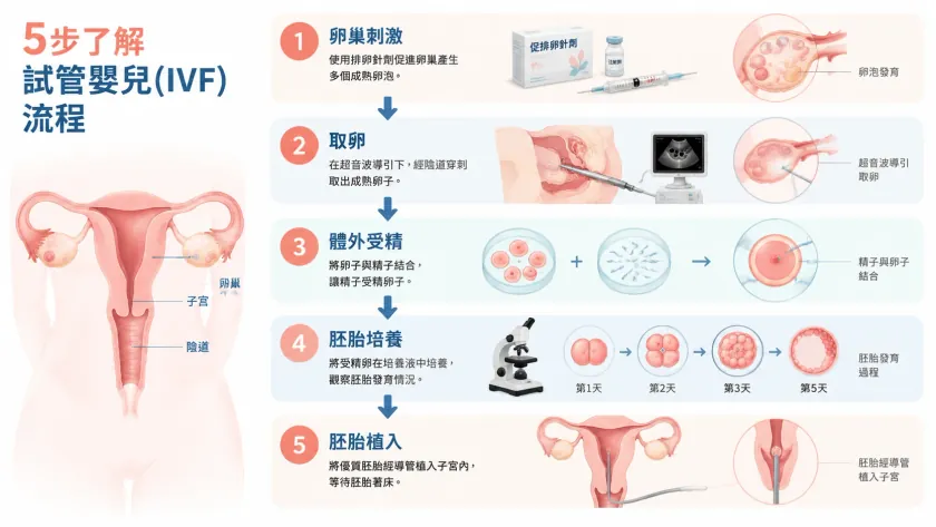 试管婴儿、IVF、体外受精有什么区别？