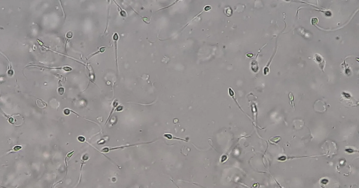What Does Normal Sperm Look Like? Color, Texture & Liquefaction