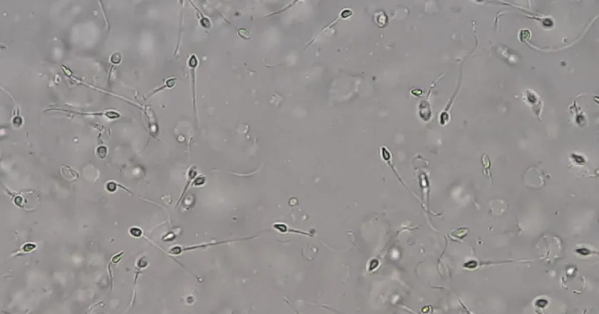 What Does Normal Sperm Look Like? Color, Texture & Liquefaction