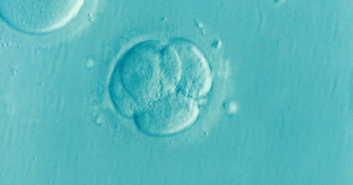 ZyMoT IVF 微流控精子筛选指南：原理、费用与临床证据