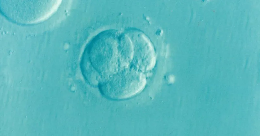 ZyMoT IVF 微流控精子筛选指南：原理、费用与临床证据
